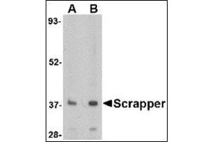 Western blot analysis of SCRAPPER in A20 cell lysate with this product at (A) 0. (FBXL20 antibody  (N-Term))