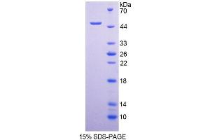 SDS-PAGE analysis of Human HCRP1 Protein. (VPS37A Protein)