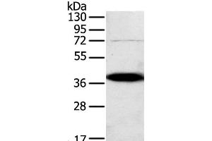 Western Blot analysis of A375 cell using SPARC Polyclonal Antibody at dilution of 1:500 (SPARC antibody)