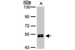 WB Image Sample(30 μg of whole cell lysate) A:HeLa S3, 7. (RPS6KB2 antibody  (Center))