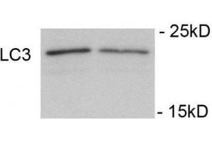 Immunoblots of SH-SY5Y cells treated with rapamycin for 1 h was probed with phospho-LC3C antibody. (LC3C antibody  (pSer12))
