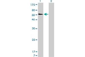 Western Blotting (WB) image for anti-Sorting Nexin 1 (SNX1) (AA 166-276) antibody (ABIN598935) (Sorting Nexin 1 antibody  (AA 166-276))