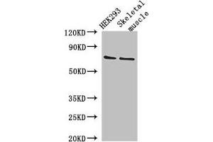 Western Blot Positive WB detected in: HEK293 whole cell lysate, Mouse skeletal muscle tissue All lanes: EFCAB7 antibody at 2. (EFCAB7 antibody  (AA 1-158))