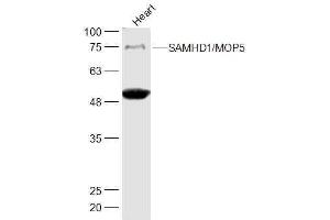 Mouse Heart lysates probed with SAMHD1'MOP5 Polyclonal Antibody, Unconjugated  at 1:500 dilution and 4˚C overnight incubation. (SAMHD1 antibody  (AA 256-370))