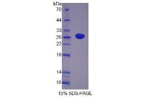 SDS-PAGE analysis of Rat NT5M Protein. (NT5M Protein)
