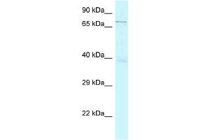 WB Suggested Anti-GSG2 Antibody Titration: 1. (GSG2 antibody  (N-Term))