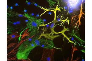View of mixed neuron/glial cultures stained with Vimentin antibody (green) and rabbit antibody to GFAP antibody (red). (Vimentin antibody)