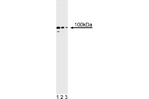 Western Blotting (WB) image for anti-PMS2 Postmeiotic Segregation Increased 2 (S. Cerevisiae) (PMS2) antibody (ABIN967525) (PMS2 antibody)