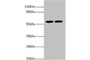 Western blot All lanes: PAIP1 antibody at 8 μg/mL Lane 1: Hela whole cell lysate Lane 2: PC-3 whole cell lysate Secondary Goat polyclonal to rabbit IgG at 1/10000 dilution Predicted band size: 54, 46, 43 kDa Observed band size: 54 kDa (PAIP1 antibody  (AA 1-260))