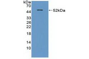 Detection of Recombinant CRAT, Mouse using Polyclonal Antibody to Carnitine Acetyltransferase (CRAT) (CRAT antibody  (AA 1-430))