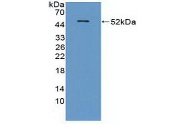 CRAT antibody  (AA 1-430)