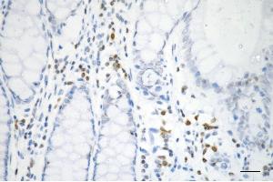 Immunohistochemistry was performed on paraffin-embedded human sigmoid colon carcinoma using histone H3 (tri methyl K27) antibody (ABIN7798967), 1:200).
