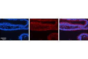 Rabbit Anti-TRIM32 Antibody  Catalog Number: ARP31692_P050  Formalin Fixed Paraffin Embedded Tissue: Human Bronchial Epithelial Tissue  Observed Staining: Cytoplasmic  Primary Antibody Concentration: 1:100  Secondary Antibody: Donkey anti-Rabbit-Cy3  Secondary Antibody Concentration: 1:200  Magnification: 20X  Exposure Time: 0. (TRIM32 antibody  (C-Term))