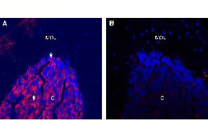 Expression of ATP1A1 in mouse cerebellum.