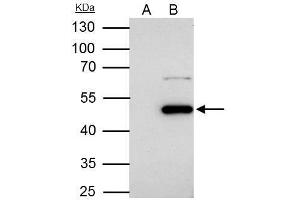 IP Image Flotillin 1 antibody [C3], C-term immunoprecipitates Flotillin 1 protein in IP experiments. (Flotillin 1 antibody  (C-Term))