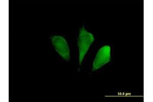 Immunofluorescence of purified MaxPab antibody to FBXO9 on HeLa cell. (FBXO9 antibody  (AA 1-437))