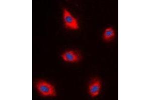 Immunofluorescent analysis of EPS8L1 staining in A549 cells. (EPS8-Like 1 antibody)
