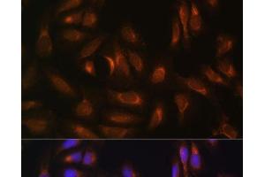 Immunofluorescence analysis of U-2 OS cells using NRBF2 Polyclonal Antibody at dilution of 1:100.