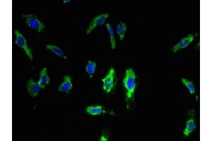 Immunofluorescent analysis of Hela cells using ABIN7173265 at dilution of 1:100 and Alexa Fluor 488-congugated AffiniPure Goat Anti-Rabbit IgG(H+L) (TMEM68 antibody  (AA 74-114))