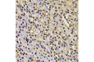 Immunohistochemistry of paraffin-embedded mouse kidney using FBXW7 antibody at dilution of 1:100 (x400 lens).
