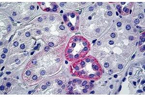 Human Kidney: Formalin-Fixed, Paraffin-Embedded (FFPE) (HSPG antibody)