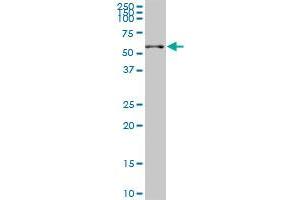 SGK2 monoclonal antibody (M03), clone 7A6. (SGK2 antibody  (AA 293-367))