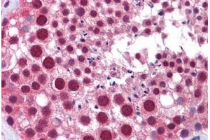 Human Testis: Formalin-Fixed, Paraffin-Embedded (FFPE) (MED17 antibody  (AA 551-652))