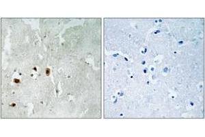 Immunohistochemistry analysis of paraffin-embedded human brain, using Tip60 (Phospho-Ser90) Antibody. (KAT5 antibody  (pSer90))