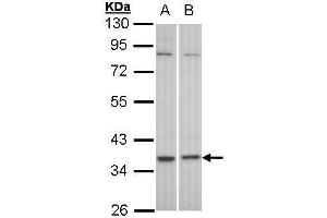 WB Image Sample (30 ug of whole cell lysate) A: HeLa B: Molt-4 , 10% SDS PAGE antibody diluted at 1:1000 (GPR77 antibody  (C-Term))