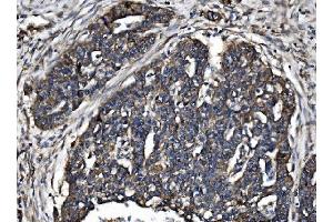 IHC analysis of TJP2/ZO2 using anti-TJP2/ZO2 antibody (ABIN7602800). (TJP2 antibody  (C-Term))