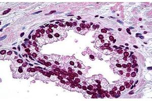 Human Prostate: Formalin-Fixed, Paraffin-Embedded (FFPE) (DLX2 antibody  (AA 1-110))
