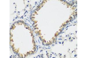 Immunohistochemistry of paraffin-embedded Mouse lung using FLT4 Polyclonal Antibody at dilution of 1:200 (40x lens). (FLT4 antibody)