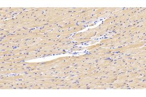 Detection of LOXL1 in Mouse Cardiac Muscle Tissue using Polyclonal Antibody to Lysyl Oxidase Like Protein 1 (LOXL1) (LOXL1 antibody  (AA 392-598))