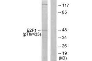 Western blot analysis of extracts from HeLa cells treated with Etoposide 25uM 24h, using E2F1 (Phospho-Thr433) Antibody. (E2F1 antibody  (pThr433))
