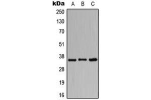 Western blot analysis of CD157 expression in HeLa (A), Raw264. (BST1 antibody  (Center))