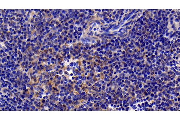 NFkB antibody  (AA 352-439)