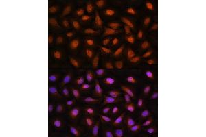Immunofluorescence analysis of U2OS cells using CTBP2 Rabbit pAb (ABIN1679396, ABIN3015896, ABIN3015897 and ABIN6219473) at dilution of 1:100.