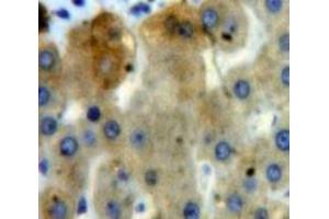 Used in DAB staining on fromalin fixed paraffin-embedded Liver tissue (EPYC antibody  (AA 110-317))