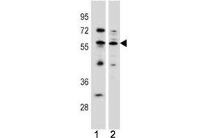 KLF4 antibody western blot analysis in (1) MCF-7 (2) K562 lysate.