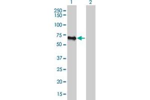 Western Blot analysis of FBLIM1 expression in transfected 293T cell line by FBLIM1 monoclonal antibody (M10), clone 5E11. (FBLIM1 antibody  (AA 270-373))