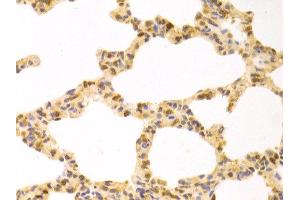 Immunohistochemistry of paraffin-embedded rat lung using STIP1 antibody at dilution of 1:100 (x400 lens).