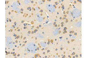 ABIN6257892 and ABIN6274756 at 1/100 staining Mouse brain tissue by IHC-P. (RPS4X antibody  (Internal Region))