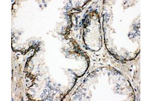 Immunohistochemistry (IHC) image for anti-Signal Sequence Receptor gamma (SSRg) (AA 8-23) antibody (ABIN3032563)