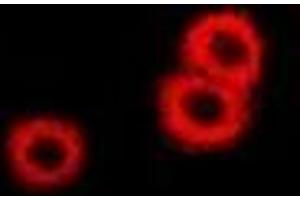 Immunofluorescent analysis of PSAT1 staining in U2OS cells. (PSAT1 antibody)