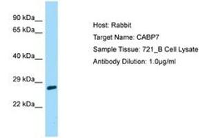 Image no. 1 for anti-Calcium Binding Protein 7 (CABP7) (AA 137-186) antibody (ABIN6750164)