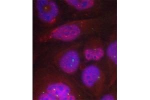 Immunofluorescence staining of methanol-fixed HeLa cells using Phospho-RELA-S276 antibody. (NF-kB p65 antibody  (pSer276))