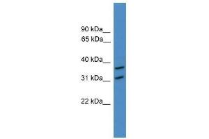 Western Blot showing OTUD6A antibody used at a concentration of 1-2 ug/ml to detect its target protein. (OTUD6A antibody  (N-Term))