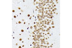 Immunohistochemistry (IHC) image for anti-Protein Arginine Methyltransferase 1 (PRMT1) (AA 20-353) antibody (ABIN3021312)