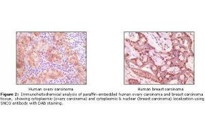 Image no. 1 for anti-Synuclein, gamma (Breast Cancer-Specific Protein 1) (SNCG) antibody (ABIN207620) (SNCG antibody)
