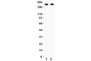 Western Blotting (WB) image for anti-Calcium Channel, Voltage-Dependent, L Type, alpha 1D Subunit (CACNA1D) (AA 1-180) antibody (ABIN3030256)